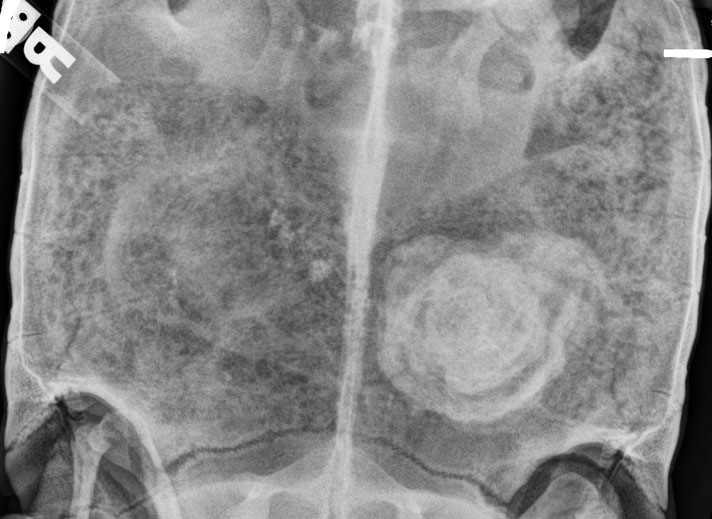 Bladder stones in a tortoise.