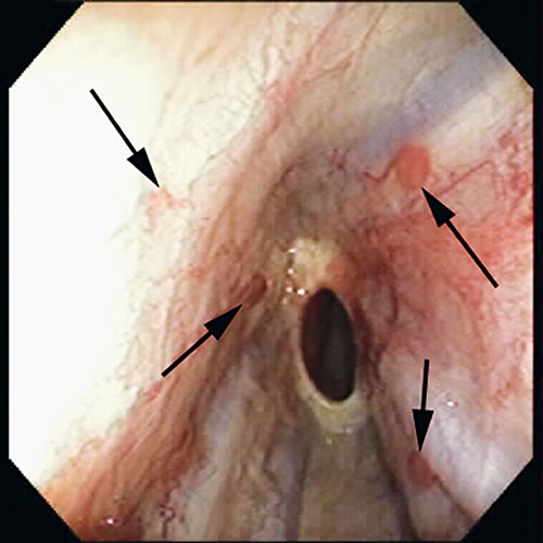 boa constrictor esophagus